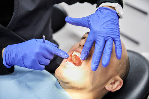 Best Knocked-Out Tooth Emergency  in Hillcrest, CA