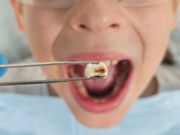 Best Tooth Pain Emergency Relief  in Hillcrest, CA