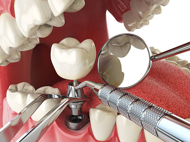 Best Broken Tooth Emergency  in Hillcrest, CA